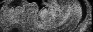 Echographie d'un embryon de souris de 12 jours - © PIV, Institut Cochin